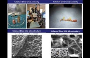 WHITE CLOT UPDATE ⚕ JOHN OLOONEY
