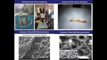 WHITE CLOT UPDATE ⚕ JOHN OLOONEY