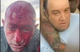 THE BONDI BEACH TERROR ATTACK BECAME ISRAEL'S ₪ MOST EMBARRASSING FALSE FLAG FLOP YET❗