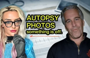 JEFFREY EPSTEINː THE AUTOPSY DETAILS NO ONE IS TALKING ABOUT