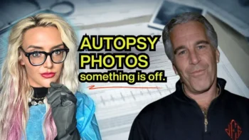 JEFFREY EPSTEINː THE AUTOPSY DETAILS NO ONE IS TALKING ABOUT