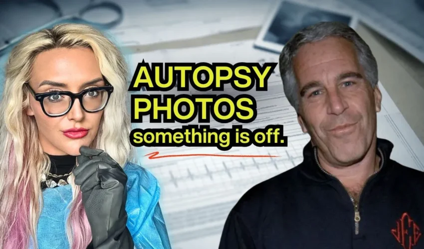 JEFFREY EPSTEINː THE AUTOPSY DETAILS NO ONE IS TALKING ABOUT