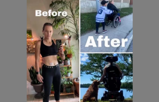 KAYLA POLLOCK HAS CONFIRMATION THAT HER PERMANENT PARALYSIS ⚕ WAS CAUSED BY THE COVID VACCINE❗
