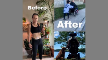 KAYLA POLLOCK HAS CONFIRMATION THAT HER PERMANENT PARALYSIS ⚕ WAS CAUSED BY THE COVID VACCINE❗