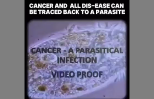 WHAT IF CANCER ISN'T 'CANCER' AT ALL 🪱 BUT PARASITES AND THEIR EGG SACKS❓