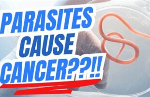 IN 1889 🪱 THEY KNEW THAT CANCER IS FROM PARASITES❗